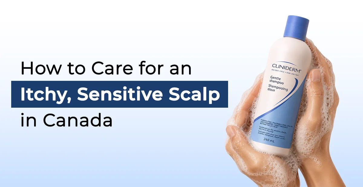 How to Care for an Itchy, Sensitive Scalp in Canada